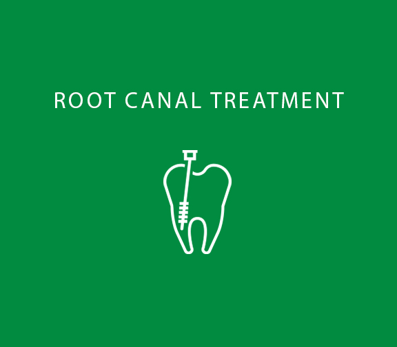 Root Canal Treatment