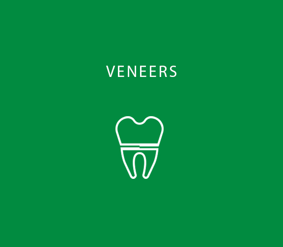 Veneers